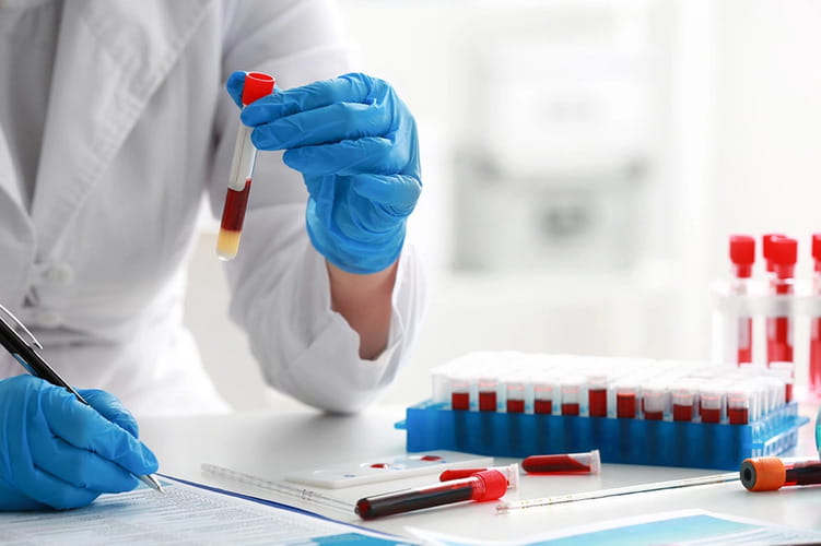 Best Immunology & Serology Lab In Surat
